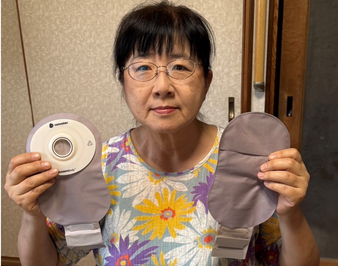 【エスティ―ムボディ™】 皮膚・排泄ケア認定看護師に指摘されて知った勘違い。試行錯誤を経た今のストーマケア。横手圭子さん（前編）