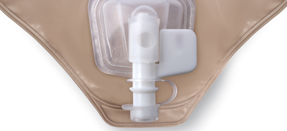 Esteem Synergy Versorgungswechsel &ndash; Schritt 13