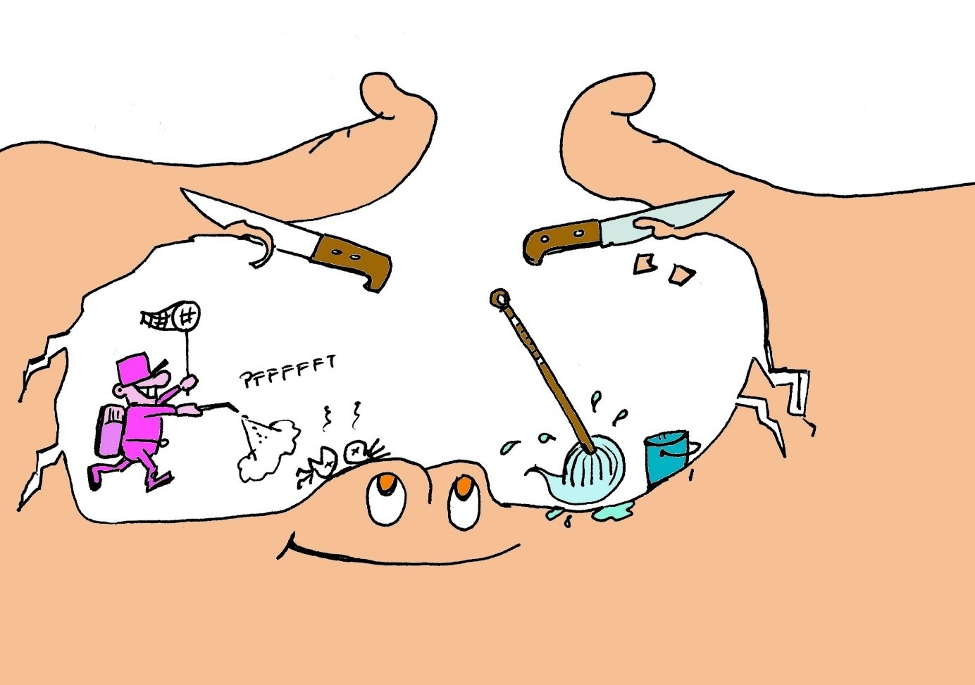 Wundheilungsphasen_Abb_V