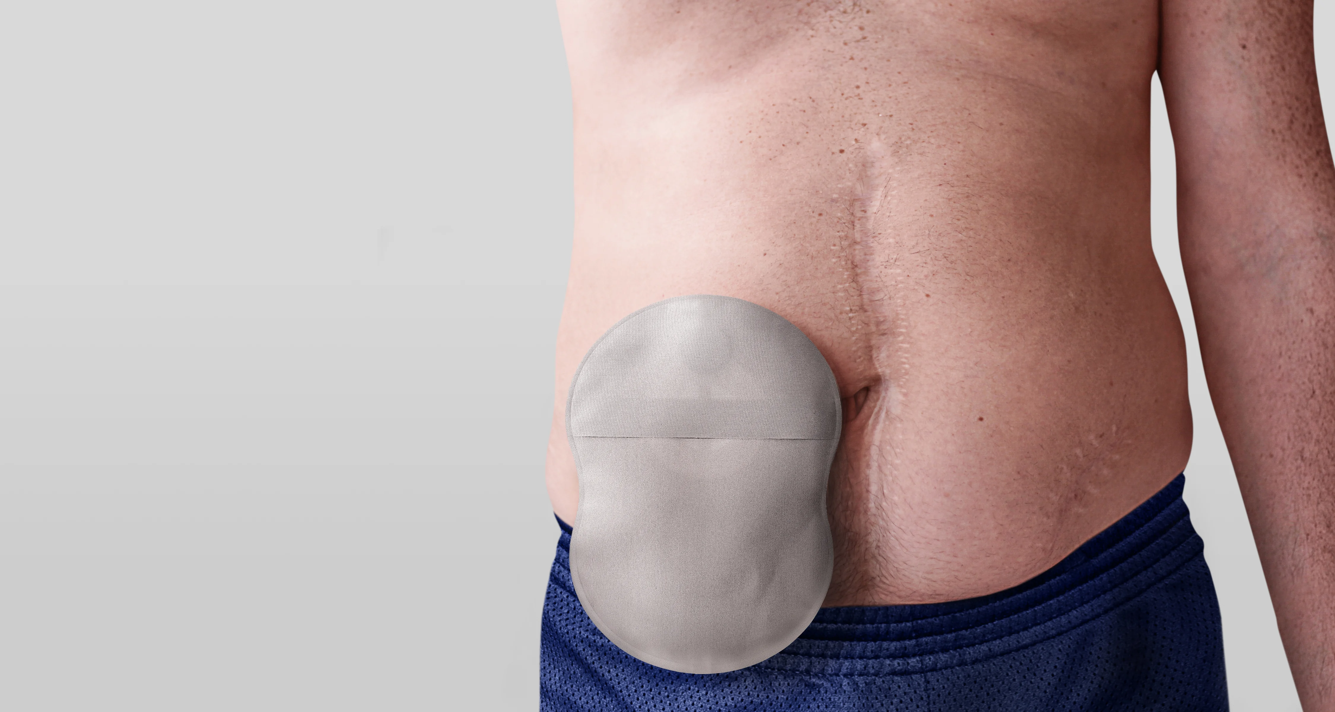 Homem vestindo uma bolsa de ostomia corporal™ de estima