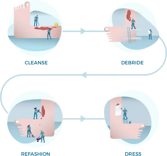 Kreslená ilustrace klíčových kroků hygieny rány: Čištění, Debride, Osvěžení, Šaty